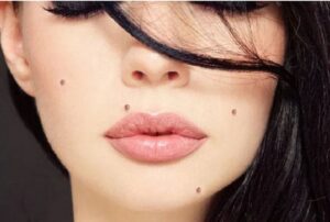 यि हुन हाम्रो शरिरमा हुने कोठिको रहस्य